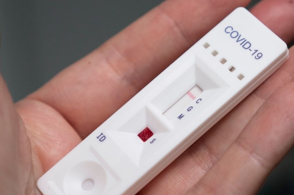 Test sierologici a docenti e ATA: c'è l'ok del Ministero