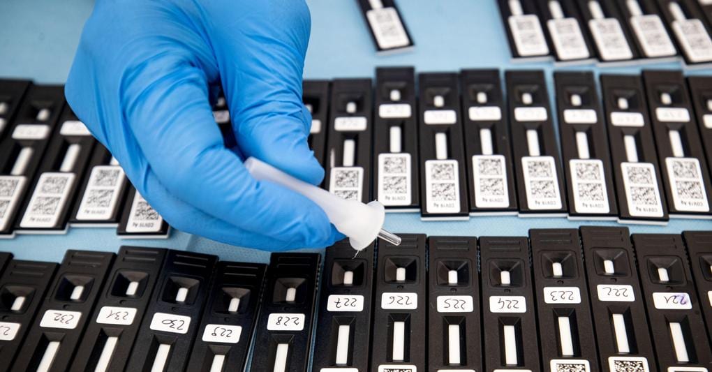 Covid, a breve l'impiego di tamponi rapidi antigenici a scuola